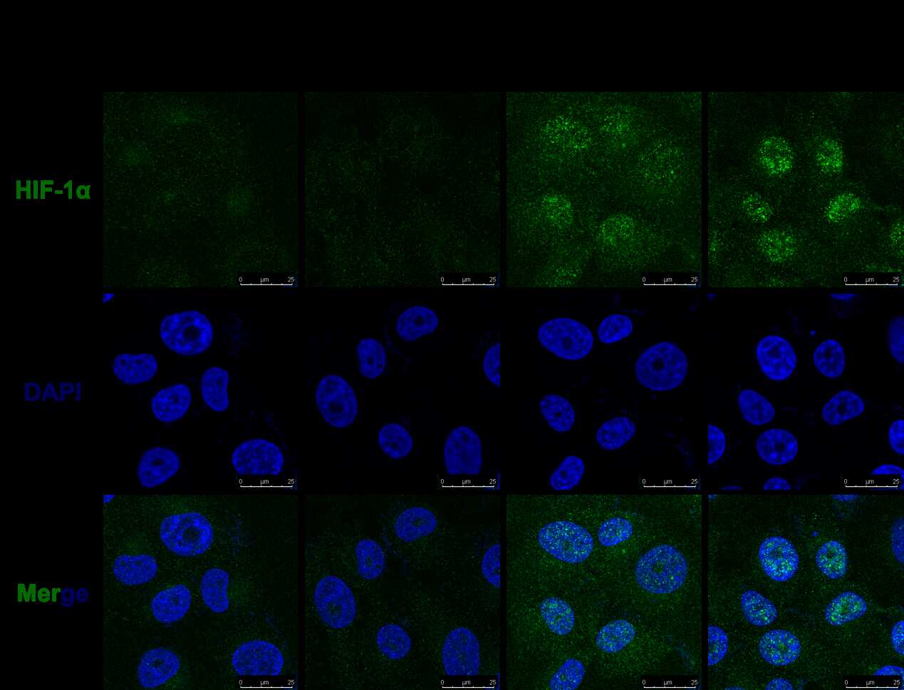 水生所揭示抗病毒天然免疫的关键转录因子IRF3调控低氧信号转导通路的分子机制